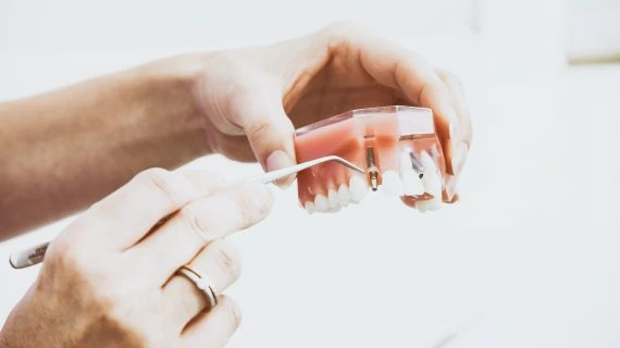 In Which Cases Can Implants Not Be Made?
