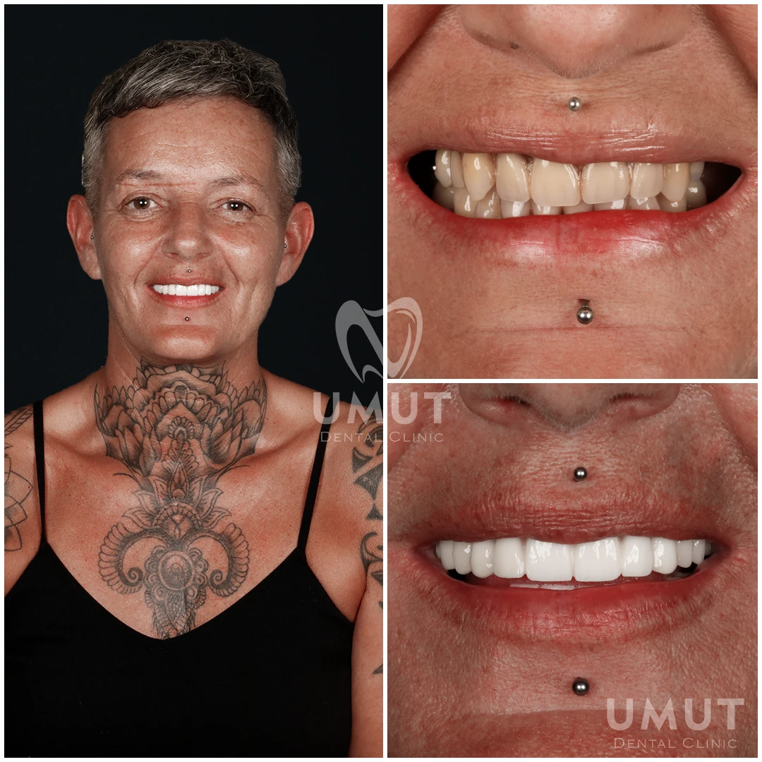 Etkinlik Fotoğrafı