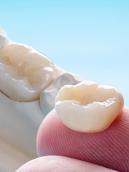 Quand Les Couronnes Sont-Elles Nécessaires?