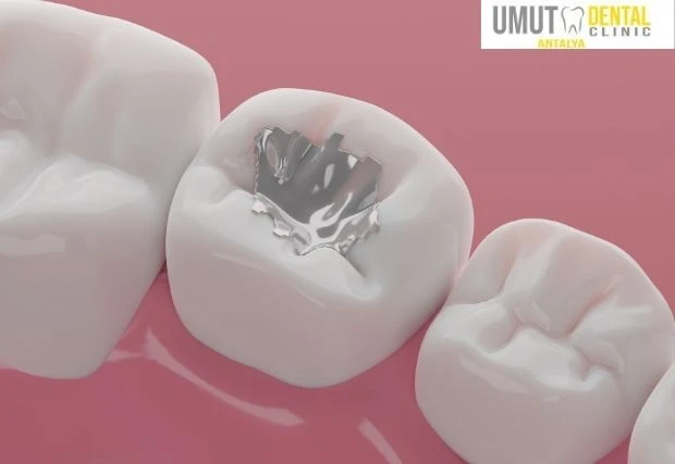 Couronnes Céramo-Métalliques