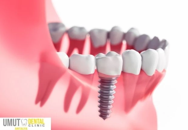 Qui est un bon candidat?