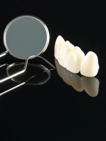 Зубные Мосты